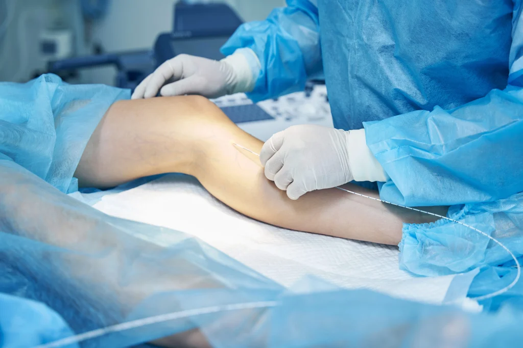 Joint Replacement Surgery in Bhopal: Cost, Procedure & Recovery Explained
